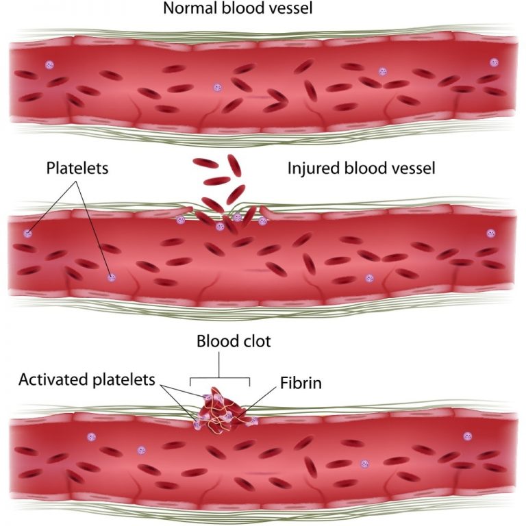 Variations and its types Overall Science